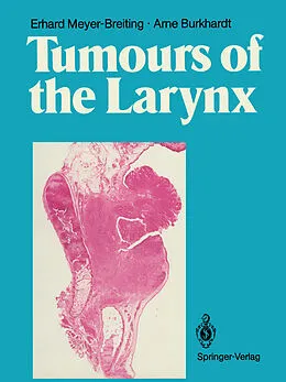 E-Book (pdf) Tumours of the Larynx von Erhard Meyer-Breiting, Arne. Burkhardt