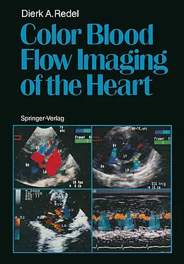 E-Book (pdf) Color Blood Flow Imaging of the Heart von Dierk A. Redel