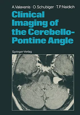 E-Book (pdf) Clinical Imaging of the Cerebello-Pontine Angle von Anton Valavanis, Othmar Schubiger, Thomas P. Naidich
