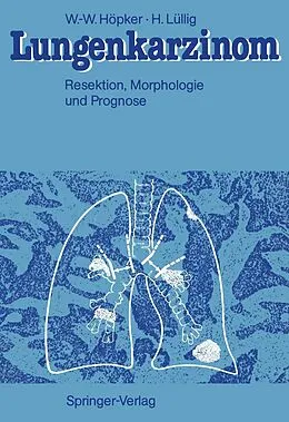 E-Book (pdf) Lungenkarzinom von Wilhelm-Wolfgang Höpker, Helmut Lüllig