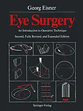 E-Book (pdf) Eye Surgery von Georg Eisner