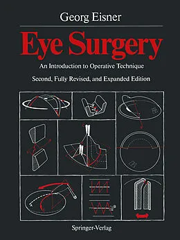 E-Book (pdf) Eye Surgery von Georg Eisner