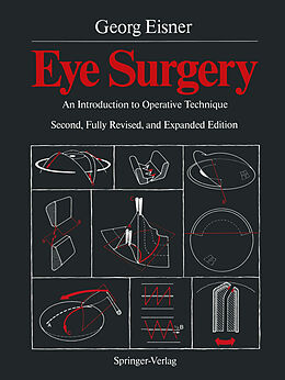Kartonierter Einband Eye Surgery von Georg Eisner