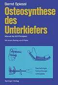 E-Book (pdf) Osteosynthese des Unterkiefers von Bernd Spiessl