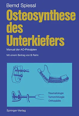 E-Book (pdf) Osteosynthese des Unterkiefers von Bernd Spiessl