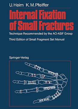 E-Book (pdf) Internal Fixation of Small Fractures von Urs Heim, Karl M. Pfeiffer