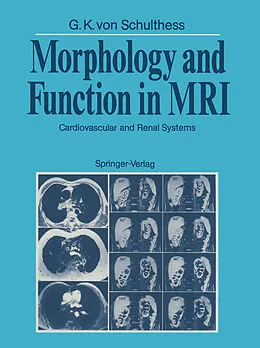 E-Book (pdf) Morphology and Function in MRI von Gustav K. V. Schulthess