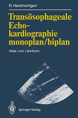 Kartonierter Einband Transösophageale Echokardiographie monoplan/biplan von Ralf Hammentgen