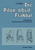 E-Book (pdf) Die Pilon-tibial-Fraktur von Urs Heim