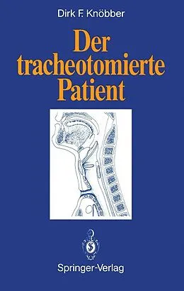 E-Book (pdf) Der tracheotomierte Patient von Dirk F. Knöbber