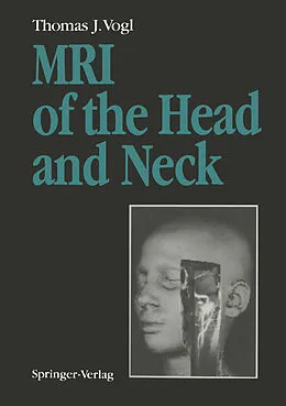 E-Book (pdf) MRI of the Head and Neck von Thomas J. Vogl