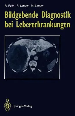 E-Book (pdf) Bildgebende Diagnostik bei Lebererkrankungen von Roland Felix, Ruth Langer, Mathias Langer