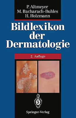 E-Book (pdf) Bildlexikon der Dermatologie von Peter Altmeyer, Martina Bacharach-Buhles, Hans Holzmann