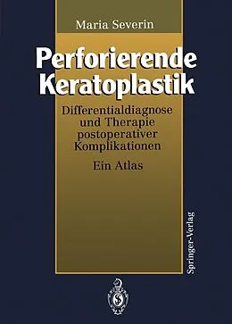 E-Book (pdf) Perforierende Keratoplastik von Maria Severin