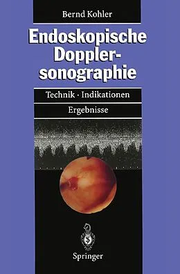 E-Book (pdf) Endoskopische Dopplersonographie von Bernd M. Kohler