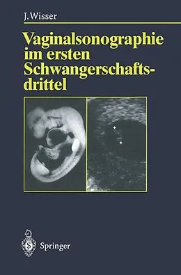 E-Book (pdf) Vaginalsonographie im ersten Schwangerschaftsdrittel von Josef Wisser