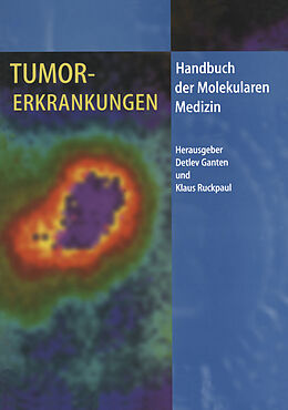 Kartonierter Einband Tumorerkrankungen von 