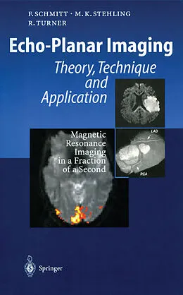E-Book (pdf) Echo-Planar Imaging von Franz Schmitt, Michael K. Stehling, Robert Turner