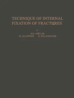 E-Book (pdf) Technique of Internal Fixation of Fractures von M. E. Müller, F. Straumann, B. G. Weber