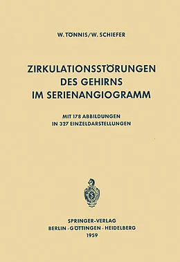 E-Book (pdf) Zirkulationsstörungen des Gehirns im Serienangiogramm von W. Tönnis, W. Schiefer
