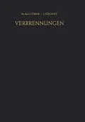 E-Book (pdf) Verbrennungen von M. Allgöwer, J. Siegrist