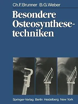 E-Book (pdf) Besondere Osteosynthesetechniken von C. F. Brunner, B. G. Weber