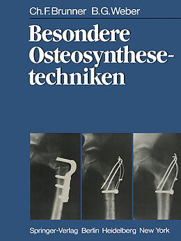 Kartonierter Einband Besondere Osteosynthesetechniken von C. F. Brunner, B. G. Weber