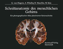 E-Book (pdf) Schnittanatomie des menschlichen Gehirns von G.v. Hagens, A. Whalley, R. Maschke