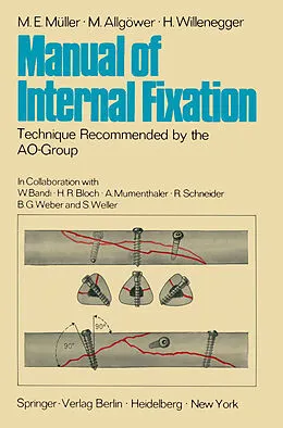 E-Book (pdf) Manual of Internal Fixation von M. E. Müller, M. Allgöwer, H. Willenegger