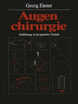 E-Book (pdf) Augenchirurgie von Georg Eisner