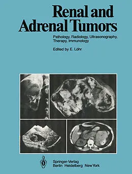 E-Book (pdf) Renal and Adrenal Tumors von R. Ackerman, H. C. Dominick, V. Fiedler