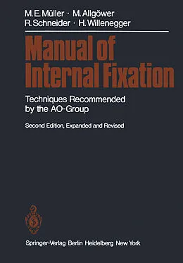 E-Book (pdf) Manual of Internal Fixation von Maurice E. Müller, Martin Allgöwer, Robert Schneider