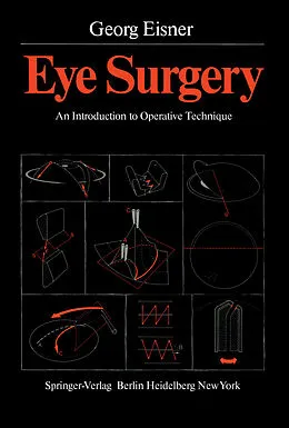 E-Book (pdf) Eye Surgery von Georg Eisner