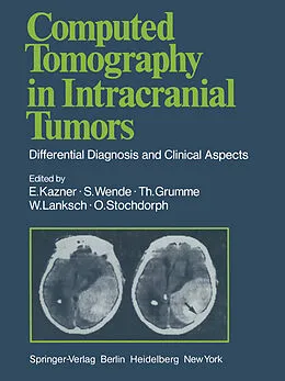 E-Book (pdf) Computed Tomography in Intracranial Tumors von G. B. Bradac, E. Kazner, K. Kretzschmar