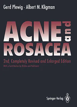 E-Book (pdf) ACNE and ROSACEA von Gerd Plewig, Albert M. Kligman