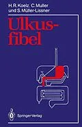 E-Book (pdf) Ulkusfibel von Hans R. Koelz, Claude Muller, Stefan Müller-Lissner