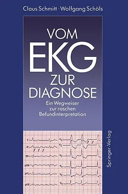 E-Book (pdf) Vom EKG zur Diagnose von Claus Schmitt, Wolfgang Schöls
