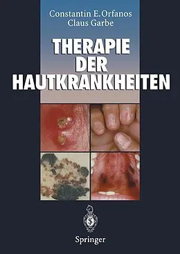 E-Book (pdf) Therapie der Hautkrankheiten von Constantin E. Orfanos, Claus Garbe