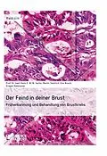 E-Book (epub) Der Feind in deiner Brust. Früherkennung und Behandlung von Brustkrebs von Hans E. W. W. Sachs, Kim Busch, Martin Smollich