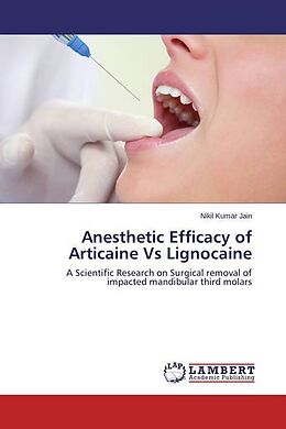 Kartonierter Einband Anesthetic Efficacy of Articaine Vs Lignocaine von Nikil Kumar Jain