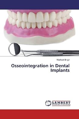 Couverture cartonnée Osseointegration in Dental Implants de Madhavi Singh