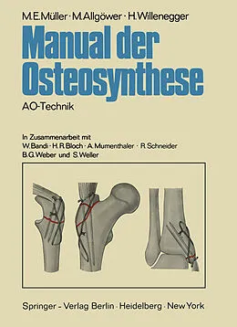 E-Book (pdf) Manual der Osteosynthese von M. E. Müller, M. Allgöwer, H. Willenegger