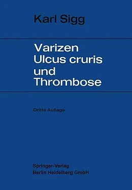 E-Book (pdf) Varicen - Ulcus Cruris und Thrombose von Karl Sigg