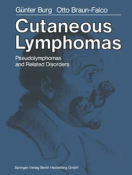 E-Book (pdf) Cutaneous Lymphomas, Pseudolymphomas, and Related Disorders von G. Burg, O. Braun-Falco