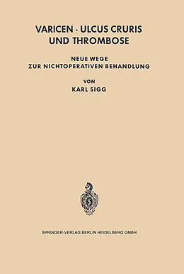E-Book (pdf) Varicen - Ulcus Cruris und Thrombose von Karl Sigg