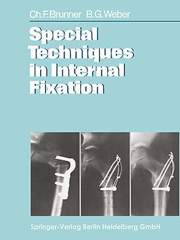 Kartonierter Einband Special Techniques in Internal Fixation von C. F. Brunner, B. G. Weber