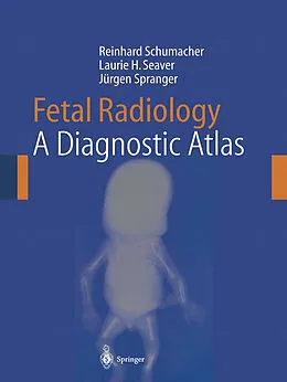 E-Book (pdf) Fetal Radiology von Reinhard Schumacher, Laurie H. Seaver, Jürgen Spranger
