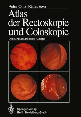 E-Book (pdf) Atlas der Rectoskopie und Coloskopie von P. Otto, K. Ewe