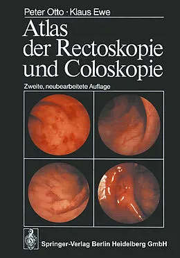 E-Book (pdf) Atlas der Rectoskopie und Coloskopie von P. Otto, K. Ewe