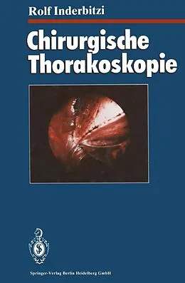 E-Book (pdf) Chirurgische Thorakoskopie von Rolf Gilbert Carl Inderbitzi